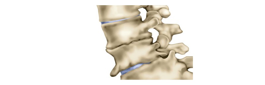 Articulations / Arthrite